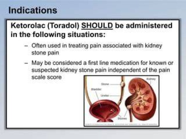 Why Does Toradol Work For Kidney Stones