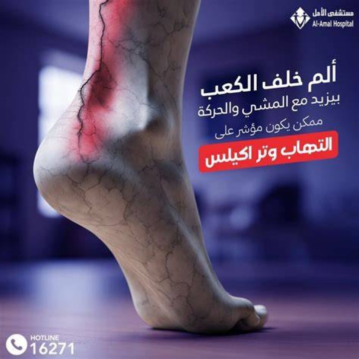 أسماء احسن 5 أدوية علاج التهاب وتر أكيلس