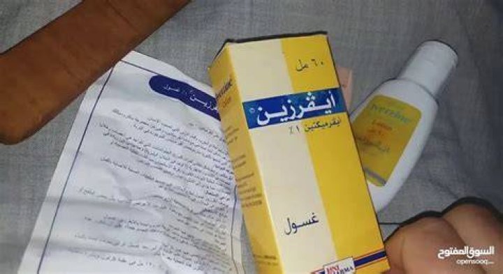 احسن اسم علاج للقمل والصيبان من الصيدلية
