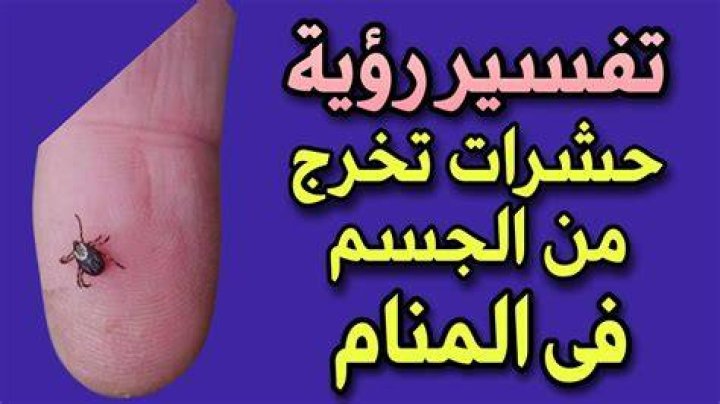 تفسير رؤية لدغة حشرة في المنام
