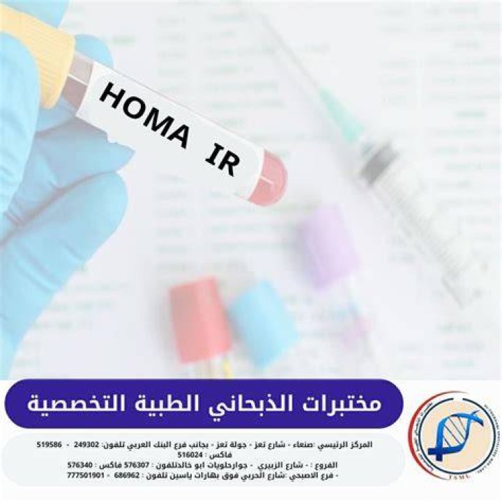 ما هو تحليل HOMA IR