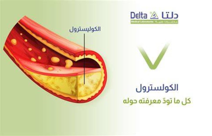 ما هي أعراض الكولسترول النفسية وعوامل تسبب ارتفاعه أو انخفاضه