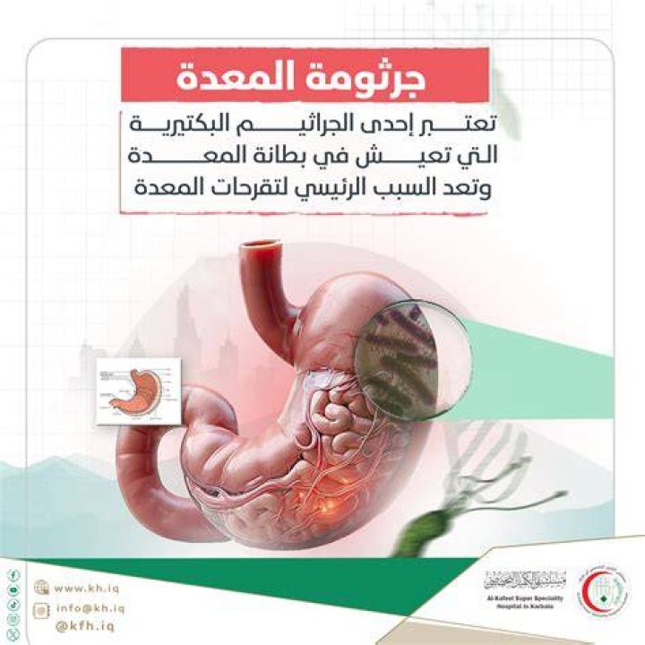 ما هي شرح خطوات علاج جرثومة المعدة بالاعشاب