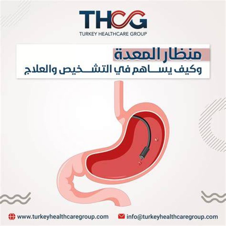 مضاعفات منظار المعدة - موقع فكرة