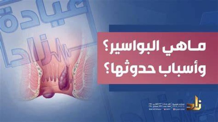 هل البواسير الخارجية خطيرة - موقع فكرة